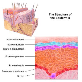 The structure of the epidermis. Blisters form in the stratum spinosum layer. © Wikimedia BruceBlaus (CC-BY 3.0)